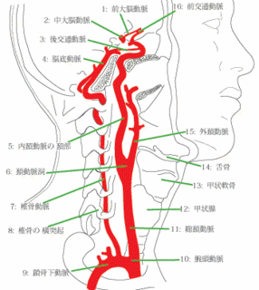 椎骨動脈.gif